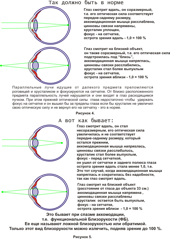 Отклонения